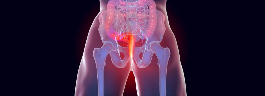 spx-clinica-spx-imagem-triagem-tumor-colorretal (2)