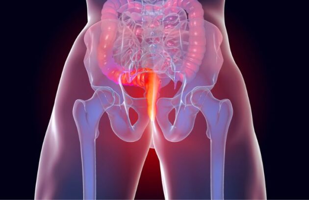 spx-clinica-spx-imagem-triagem-tumor-colorretal (2)