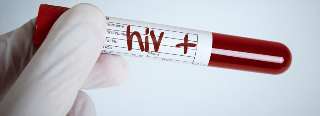 spx-clinica-spx-imagem-HIV