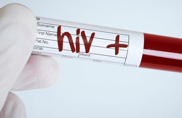 spx-clinica-spx-imagem-HIV