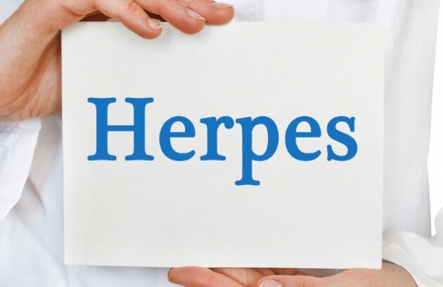 spx-clinica-spx-imagem-casos-herpes-zoster (2)