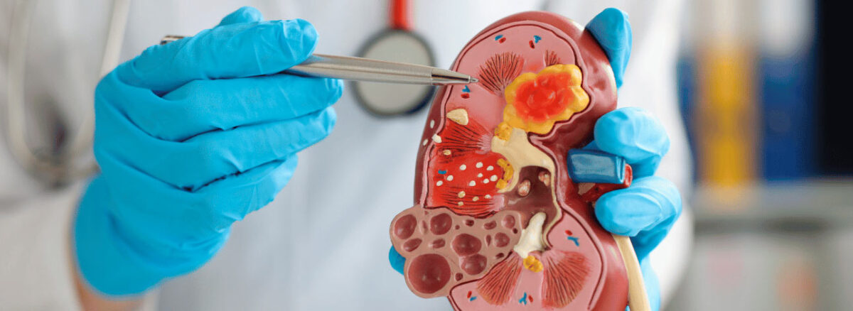 spx-clinica-spx-imagem-doencas-renais