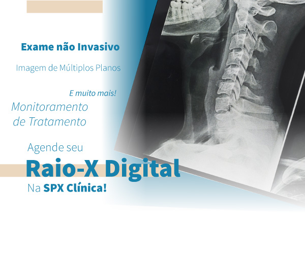 spx-clinica-spx-imagem-medica-medicina-diagnostico-raio-z-digital-exame-de-imagem