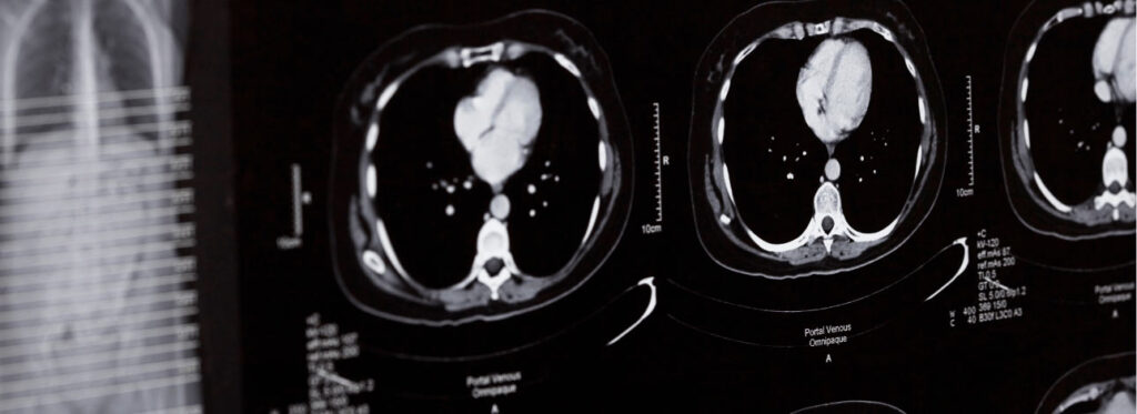 spx-clinica-spx-imagem-projeto-corpos-cerebros