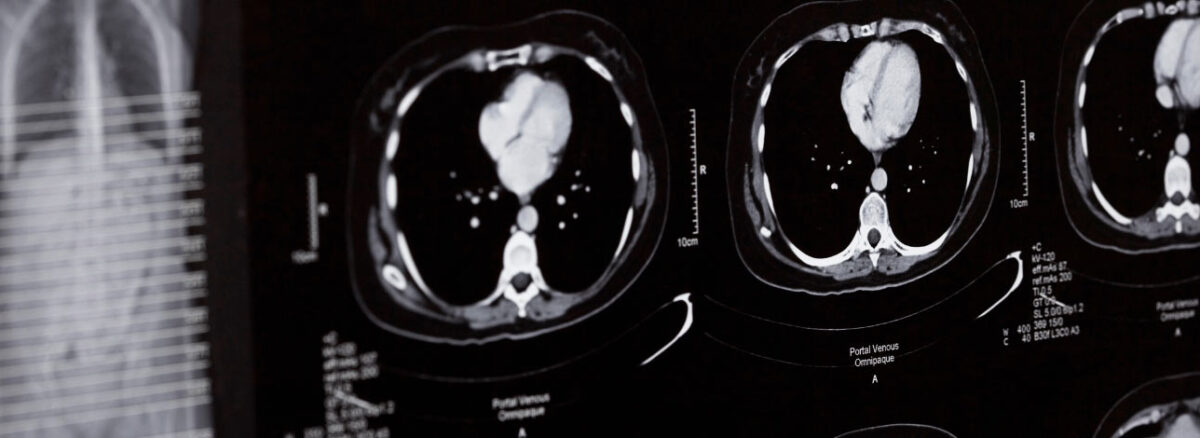 spx-clinica-spx-imagem-projeto-corpos-cerebros