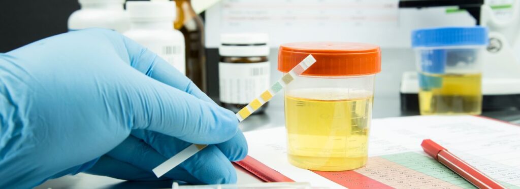 spx-clinica-spx-imagem-significado-cor-do-xixi (1)