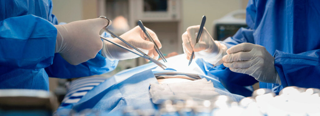 spx-clinica-spx-imagem-autotransplante-de-pulmao