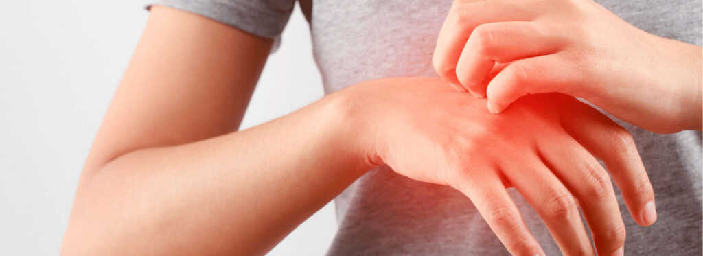 spx-clinica-spx-imagem-doenças-de-pele-no-verao