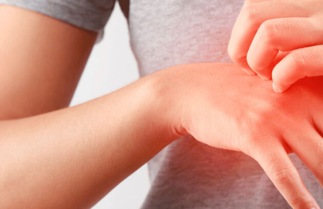 spx-clinica-spx-imagem-doenças-de-pele-no-verao