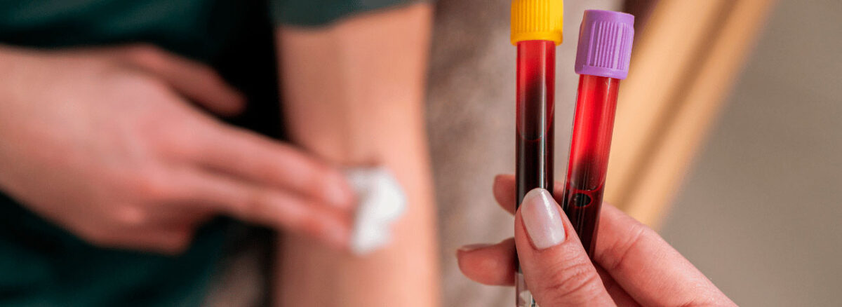 spx-clinica-spx-imagem-exame-de-vitamina-d