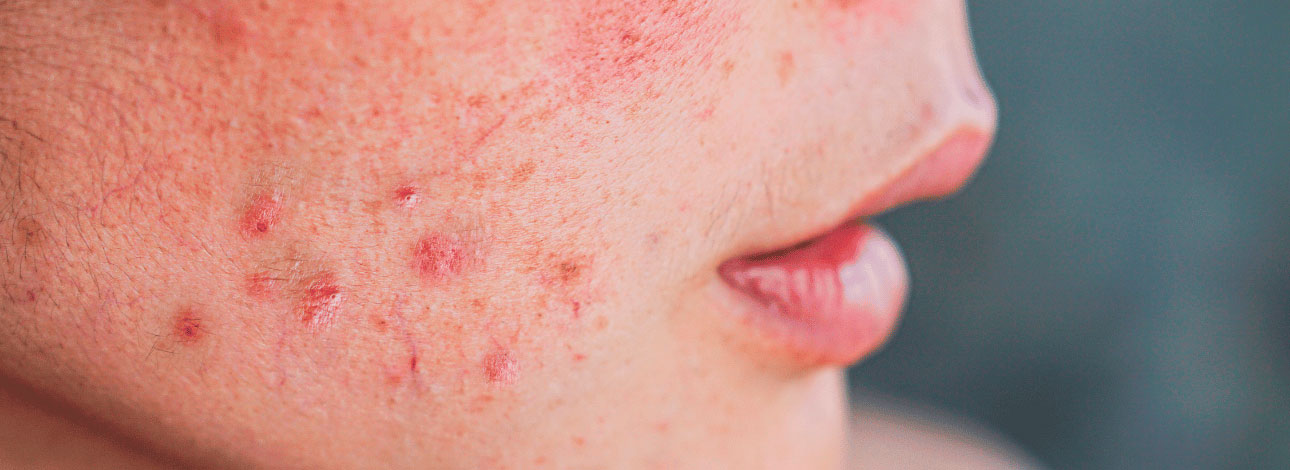 spx-clinica-spx-imagem-quais-as-doenças-de-pele