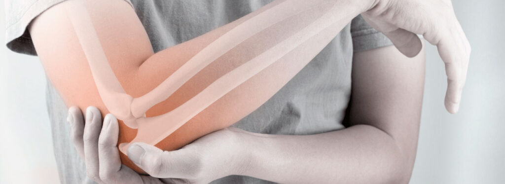 spx-clinica-spx-imagem-se-recuperar-de-uma-fratura-ossea