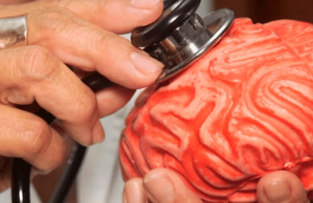 spx-clinica-spx-imagem-sodio-cerebro