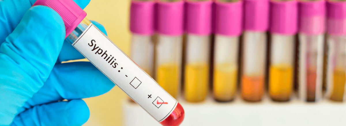 spx-clinica-spx-imagem-casos-de-sifilis