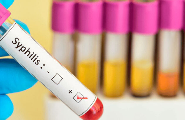 spx-clinica-spx-imagem-casos-de-sifilis