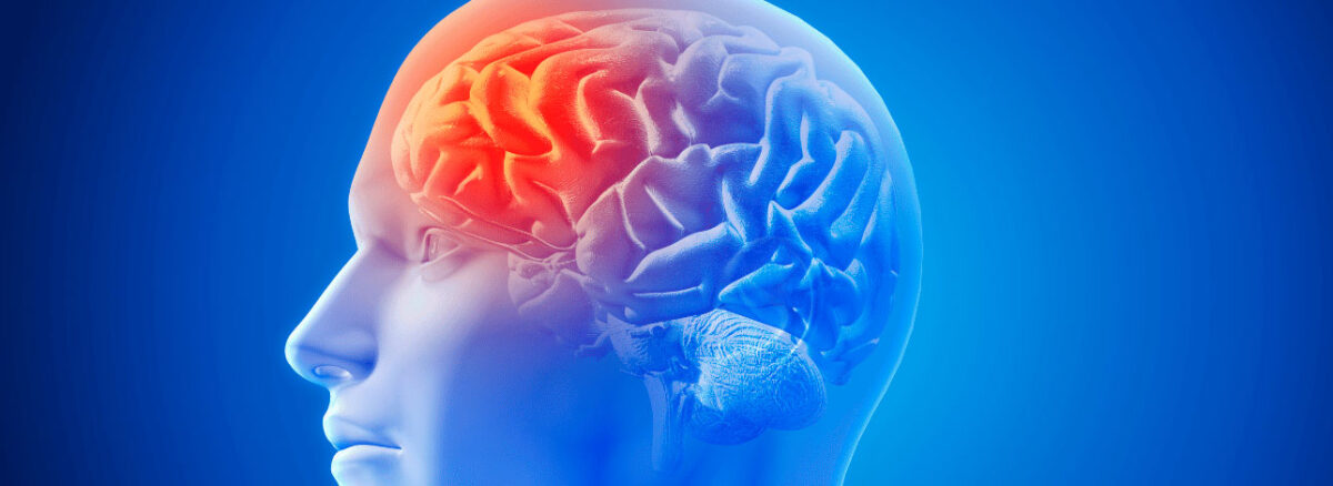 spx-clinica-spx-imagem-prevenir-avc