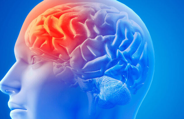 spx-clinica-spx-imagem-prevenir-avc