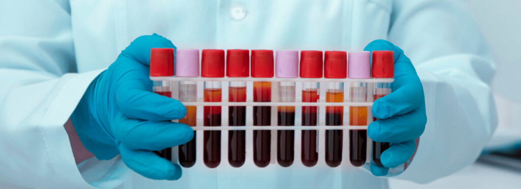 spx-clinica-spx-imagem-diagnostico-de-bipolaridade