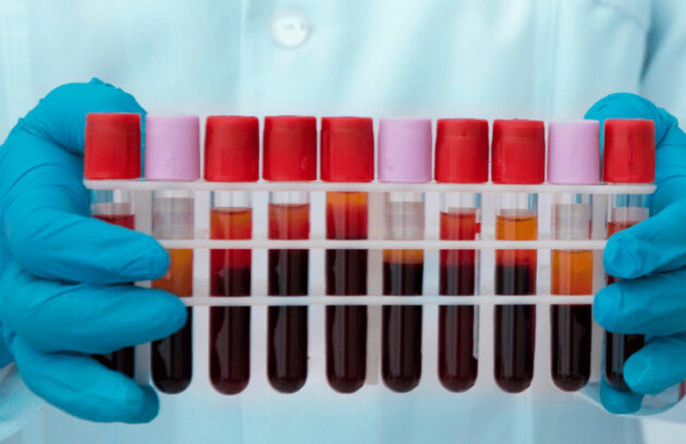 spx-clinica-spx-imagem-diagnostico-de-bipolaridade