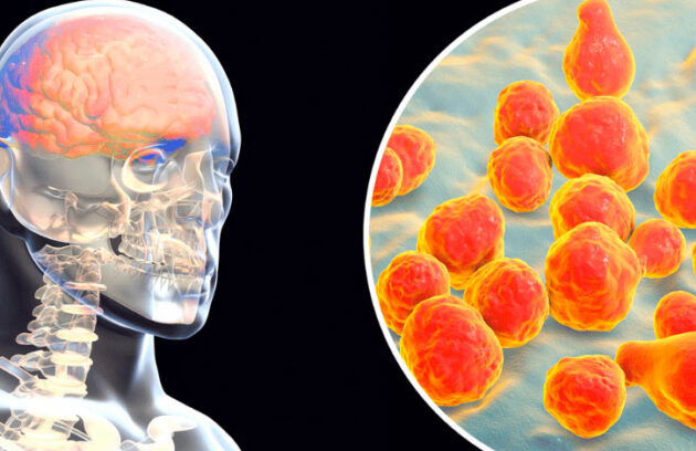 spx-clinica-spx-imagem-fungos-no-cerebro-e-sintomas-de-alzheimer