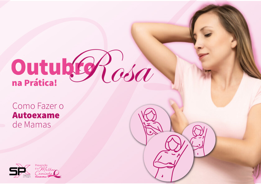 spx-imagem-spx-clinica-ebook-outubro-rosa-autoexame-de-mama