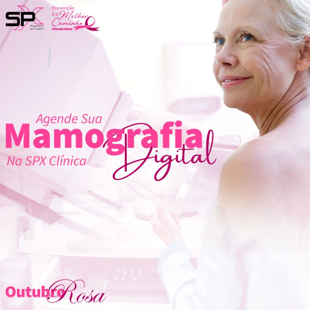 spx-imagem-spx-clinica-outubro-rosa-mamografial-2-mob
