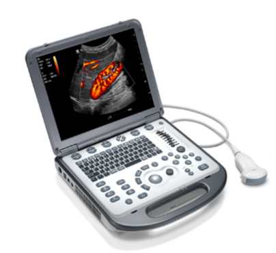 spx-clinica-spx-imagem-foto-do-ultrassom-portatil