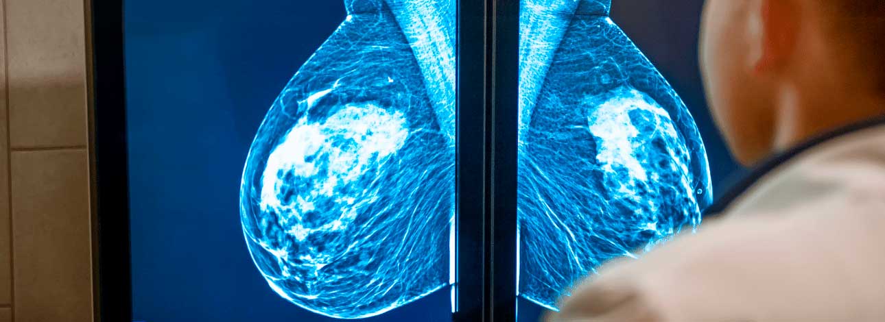 spx-clinica-spx-imagem-locacao-de-dr-mamografia