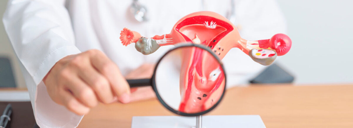 spx-clinica-spx-imagem-medicamento-para-cancer-de-colo-de-utero