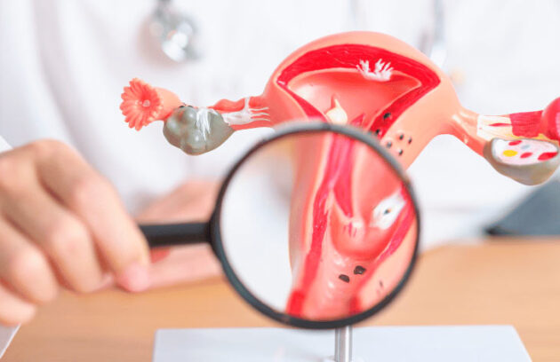 spx-clinica-spx-imagem-medicamento-para-cancer-de-colo-de-utero