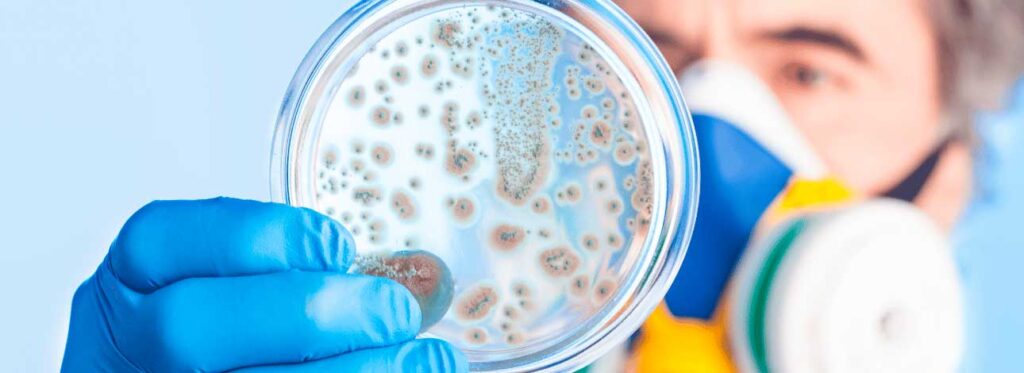 spx-clinica-spx-imagem-propagacao-de-superbacterias