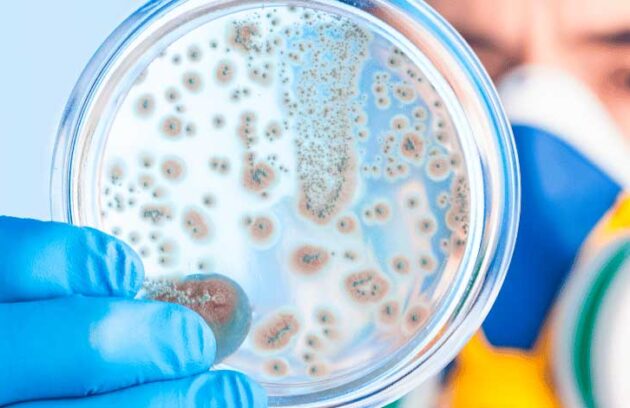 spx-clinica-spx-imagem-propagacao-de-superbacterias