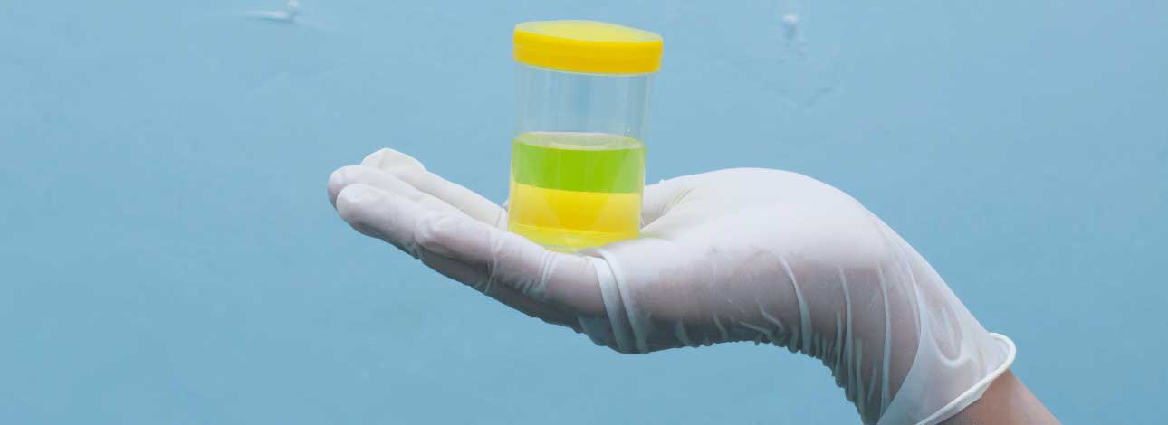 spx-clinica-spx-imagem-quando-fazer-exame-de-urina