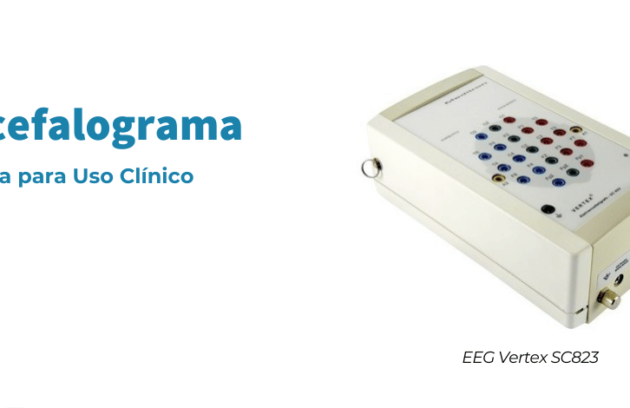 spx-clinica-spx-imagem-locacao-de-eletroencefalograma