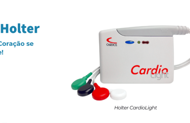 spx-clinica-spx-imagem-locacao-de-holter