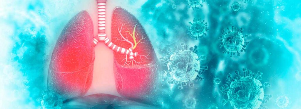 spx-clinica-spx-imagem-vacina-para-bronquiolite-no-brasil