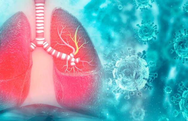 spx-clinica-spx-imagem-vacina-para-bronquiolite-no-brasil
