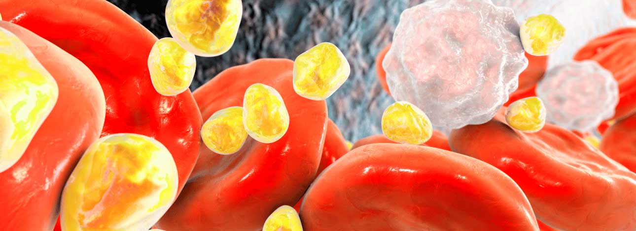 spx-clinica-spx-imagem-colesterol-no-organismo