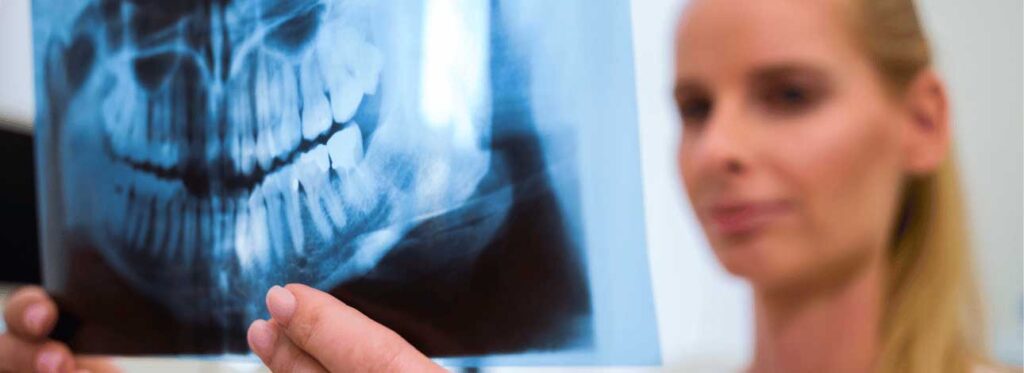 spx-clinica-spx-imagem-exame-de-scanner-dental-na-spx