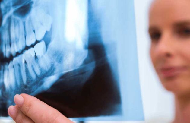 spx-clinica-spx-imagem-exame-de-scanner-dental-na-spx