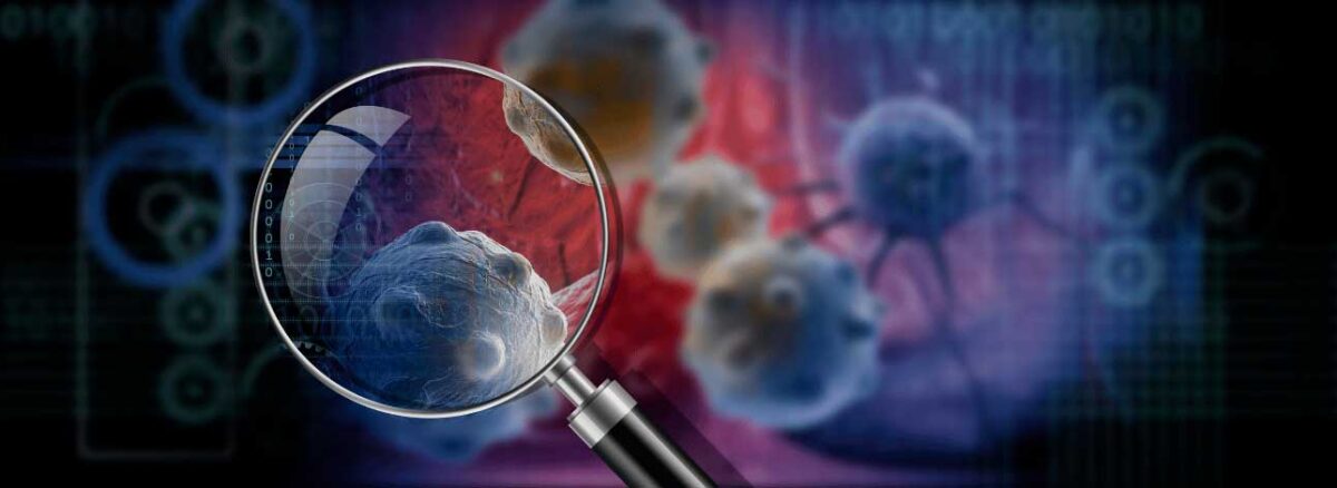 spx-clinica-spx-imagem-nanorrobos-podem-combater-tumor-de-cancer-de-bexiga