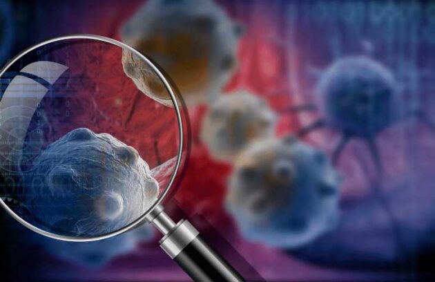 spx-clinica-spx-imagem-nanorrobos-podem-combater-tumor-de-cancer-de-bexiga