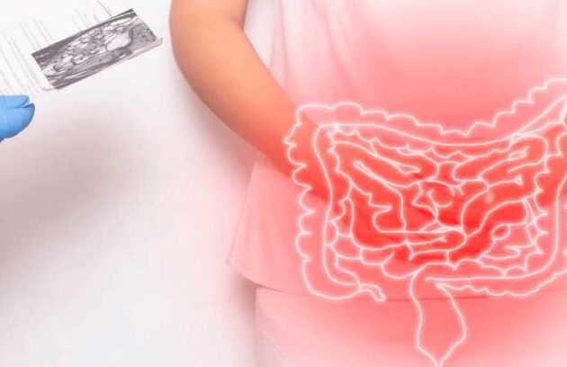 spx-clinica-spx-imagem-o-que-e-a-hidrocolonterapia