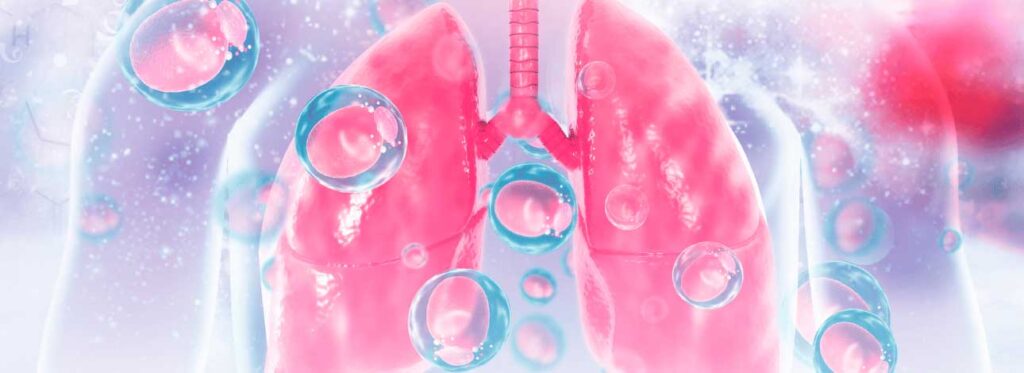 spx-clinica-spx-imagem-principais-tipos-de-pneumonia