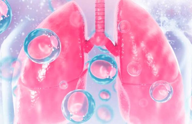 spx-clinica-spx-imagem-principais-tipos-de-pneumonia