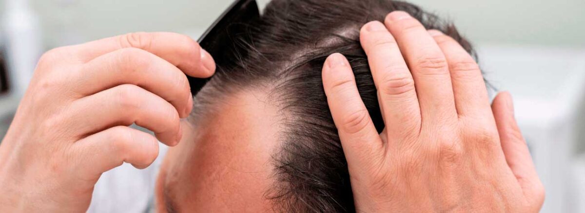 spx-clinica-spx-imagem-terapia-capilar-pode-combater-a-calvicie-spx