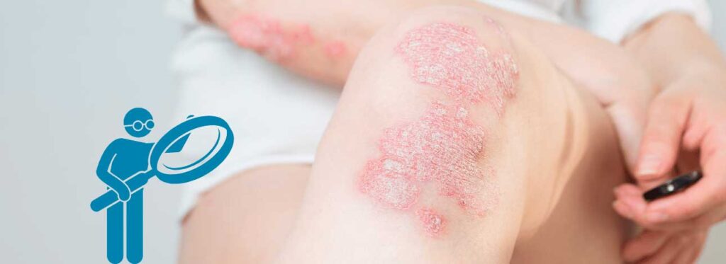 spx-clinica-spx-imagem-doencas-autoimunes-atingem-mais-as-mulheres