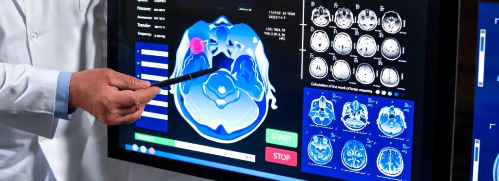 spx-clinica-spx-imagem-proteinas-podem-prever-demencia