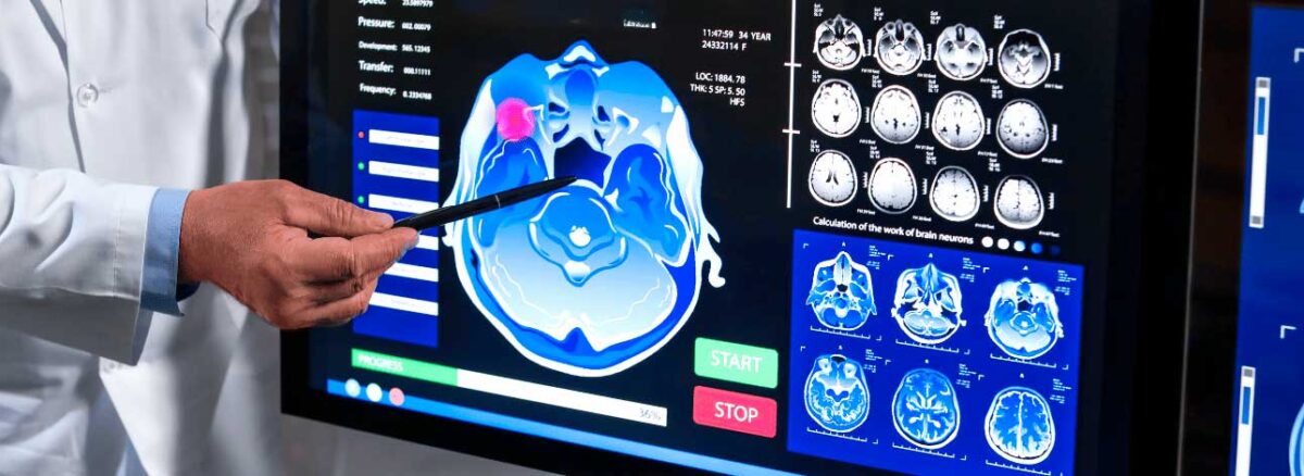 spx-clinica-spx-imagem-proteinas-podem-prever-demencia