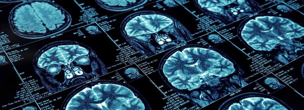 spx-clinica-spx-imagem-ressonancia-magnetica-na-spx-sta-capa